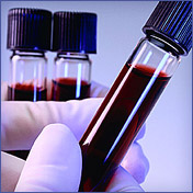 analisis-de-sangre