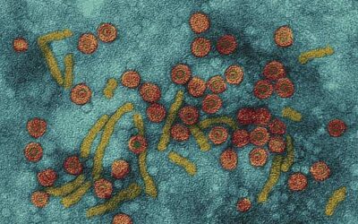 Ensayan con &eacute;xito una vacuna contra la hepatitis E