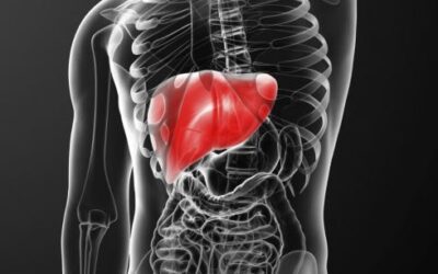 Cirrosis, una enfermedad hepática no siempre alcohólica.
