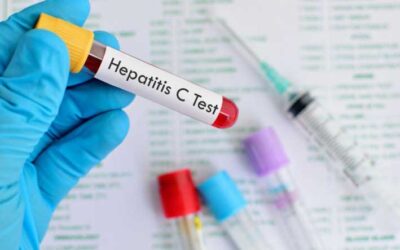 Diagnóstico de Hepatitis C en un solo paso